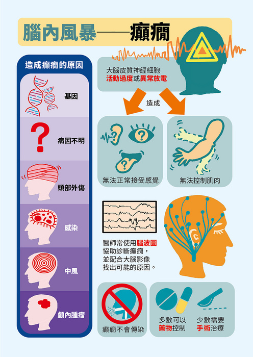 腦內風暴...癲癇